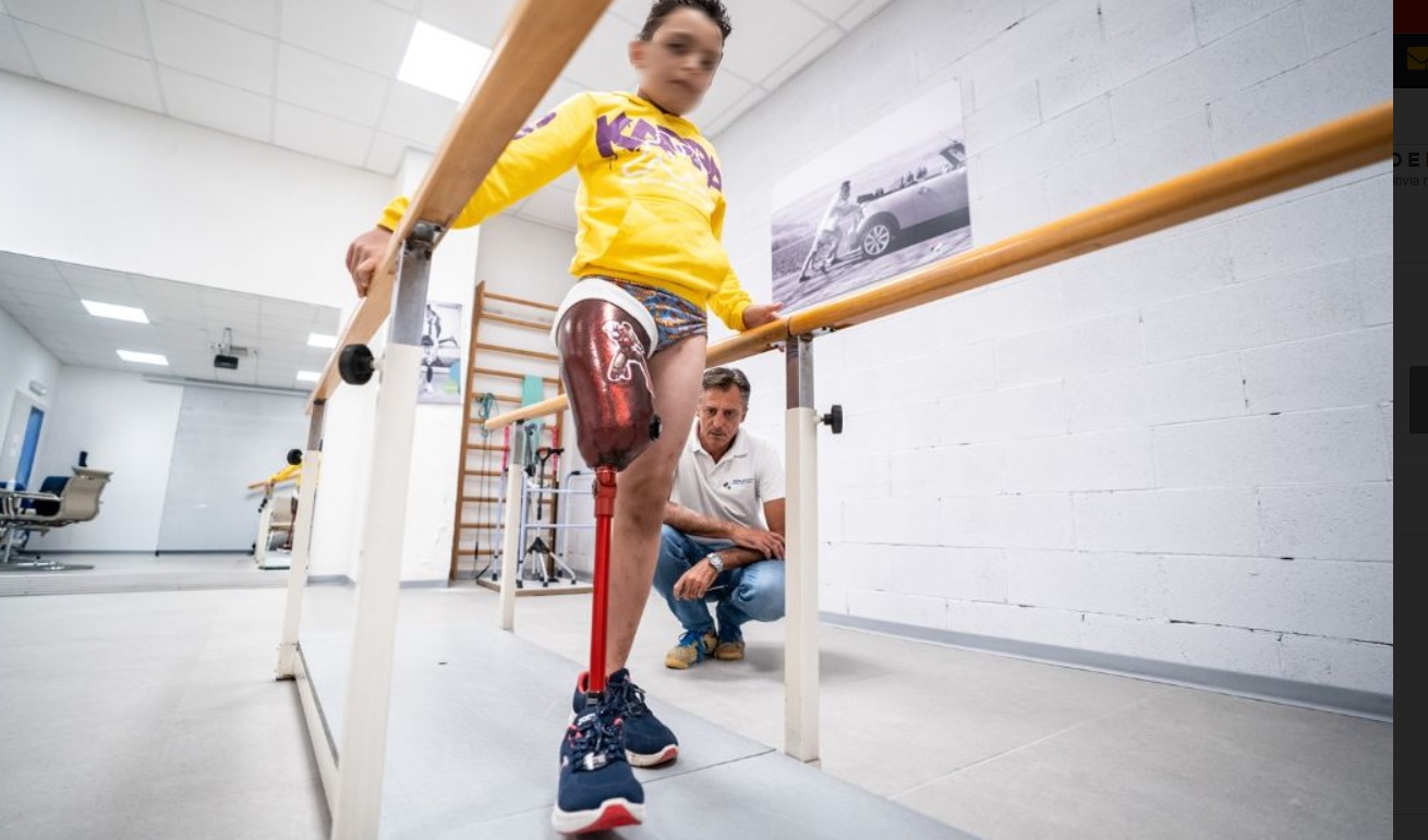 A Torino il piccolo Assad, ferito a Gaza, ha ricevuto una nuova protesi – Ora ricomincerà una nuova vita