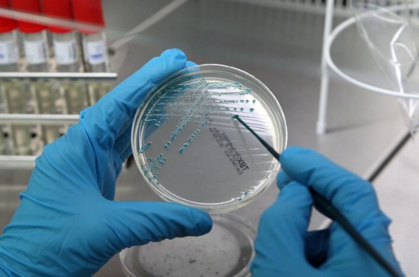 A Milano scoppia l’allarme legionella – 11 ricoverati e 1 morto. Il quartiere colpito.